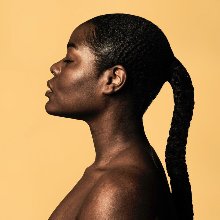 Hyperpigmentation in Skin of Colour – Safe & Effective Treatments for Darker Skin Tones