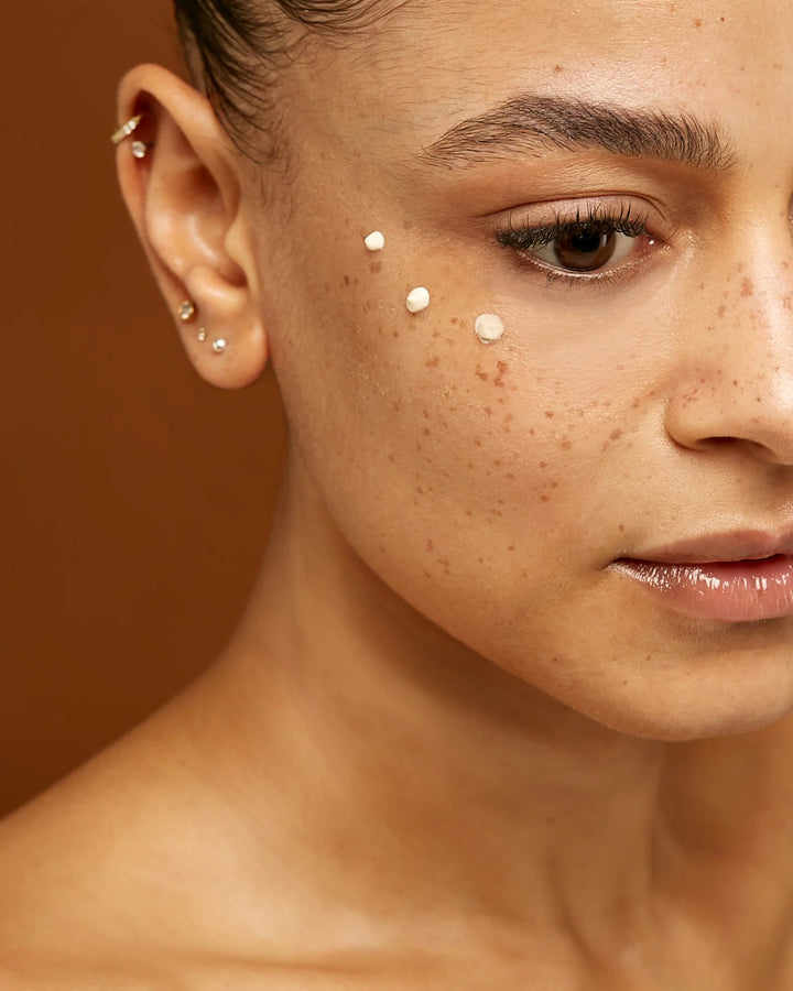 Everything You Should Know About Under Eye Microneedling + Polynucleotides Treatment