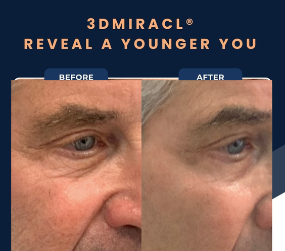 UltraClear Laser Skin Resurfacing