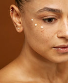 Anti-wrinkle treatment with Alluzience (Express Toxin)