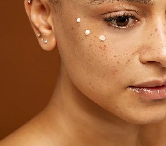 Anti-wrinkle treatment with Alluzience (Express Toxin)