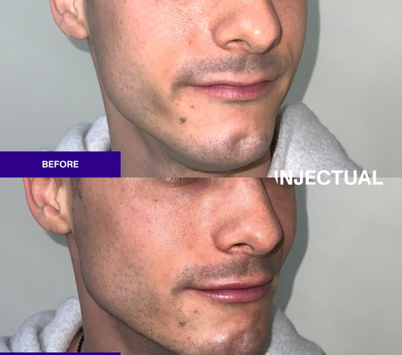 Profile Balancing
