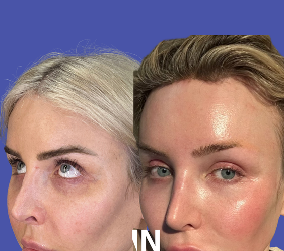 The Injectual Polynucleotide Cocktail XL