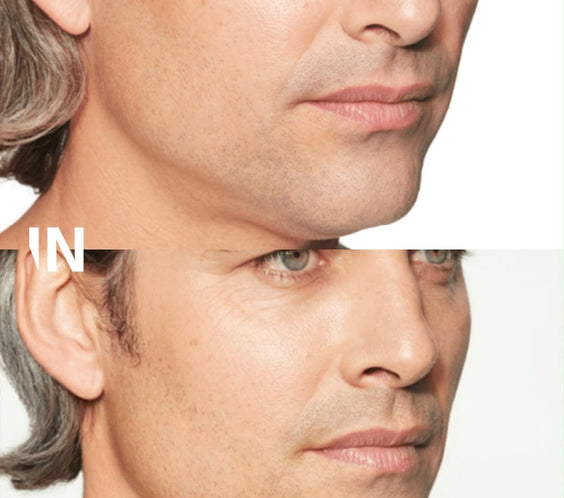 Sculptra Skinbooster