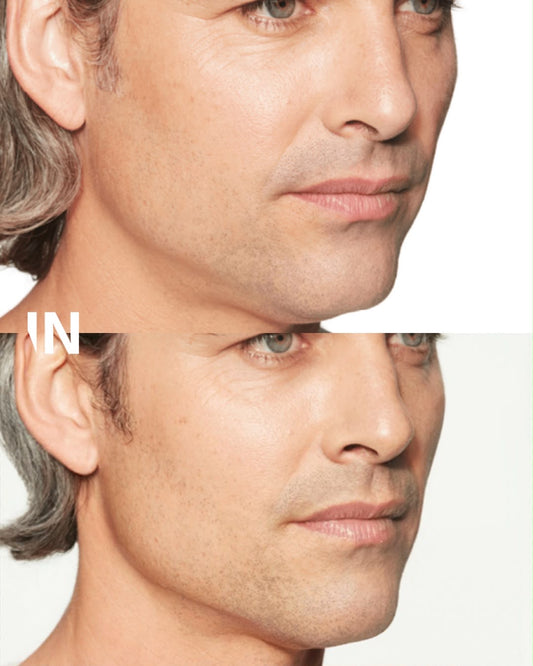 Sculptra Skinbooster