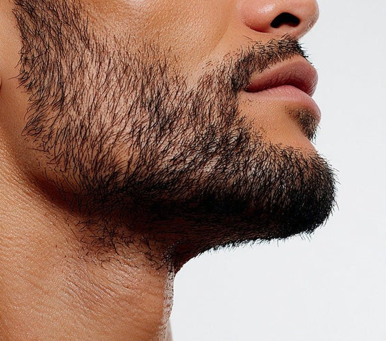 Laser Hair Removal for Men