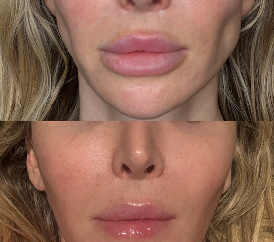 The Injectual Polynucleotide Cocktail XL