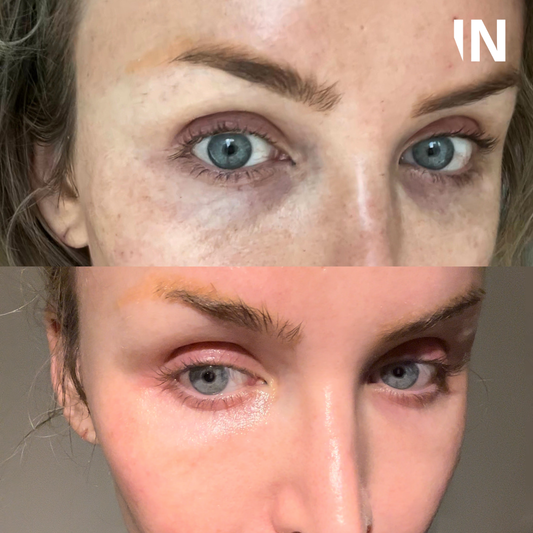 Plinest Polynucleotides