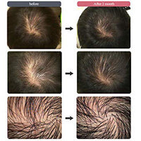 Hair Filler Treatment