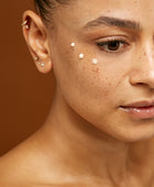 Polynucleotides under eyes face main picture
